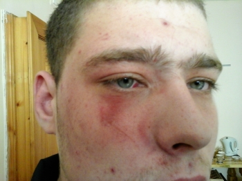 � ��� ������������� ���� ��������� ������ �� �������� ���������� ���������� �� ���������